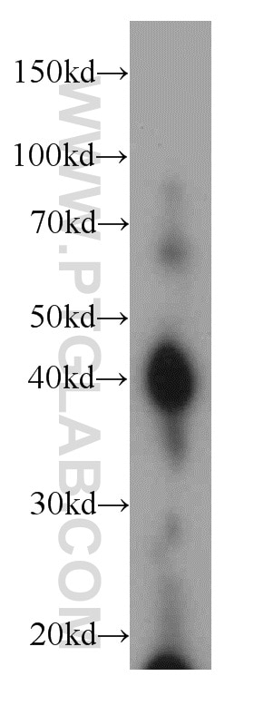 Western Blot (WB) analysis of HeLa cells using AIM2 Polyclonal antibody (20590-1-AP)