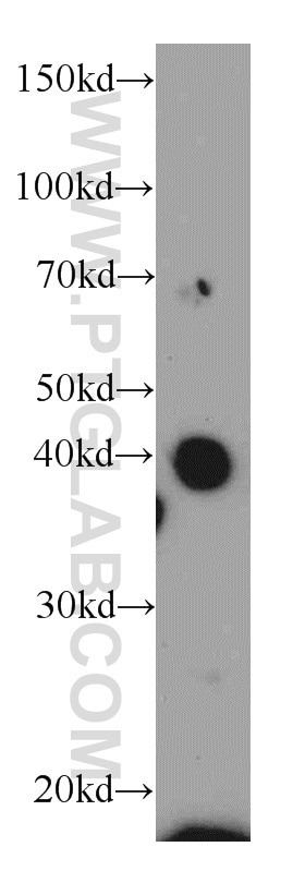 Western Blot (WB) analysis of Jurkat cells using AIM2 Polyclonal antibody (20590-1-AP)