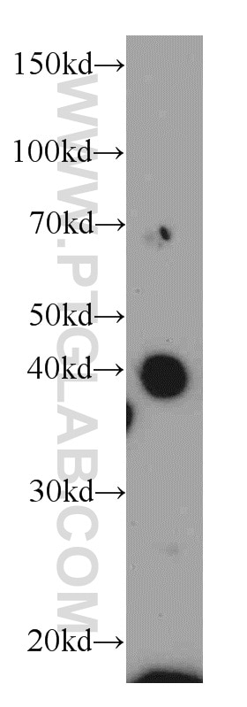WB analysis of Jurkat using 20590-1-AP