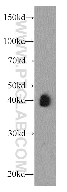 Western Blot (WB) analysis of SH-SY5Y cells using AIM2 Polyclonal antibody (20590-1-AP)