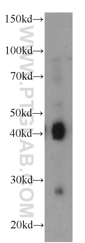 Western Blot (WB) analysis of MCF-7 cells using AIM2 Polyclonal antibody (20590-1-AP)