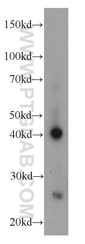 Western Blot (WB) analysis of A549 cells using AIM2 Polyclonal antibody (20590-1-AP)
