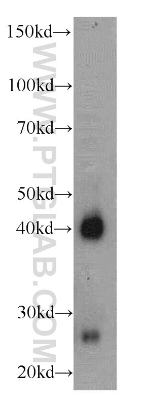 Western Blot (WB) analysis of COLO 320 cells using AIM2 Polyclonal antibody (20590-1-AP)
