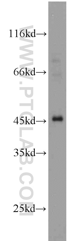 Western Blot (WB) analysis of HepG2 cells using AIM2 Polyclonal antibody (20590-1-AP)