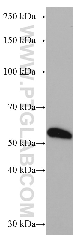 Western Blot (WB) analysis of human heart tissue using AIM2 Monoclonal antibody (66902-1-Ig)