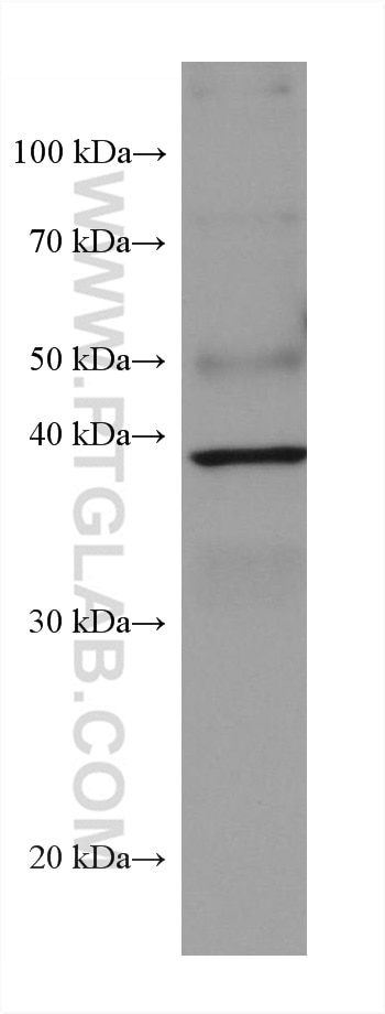 Western Blot (WB) analysis of rabbit spleen tissue using AIM2 Monoclonal antibody (66902-1-Ig)