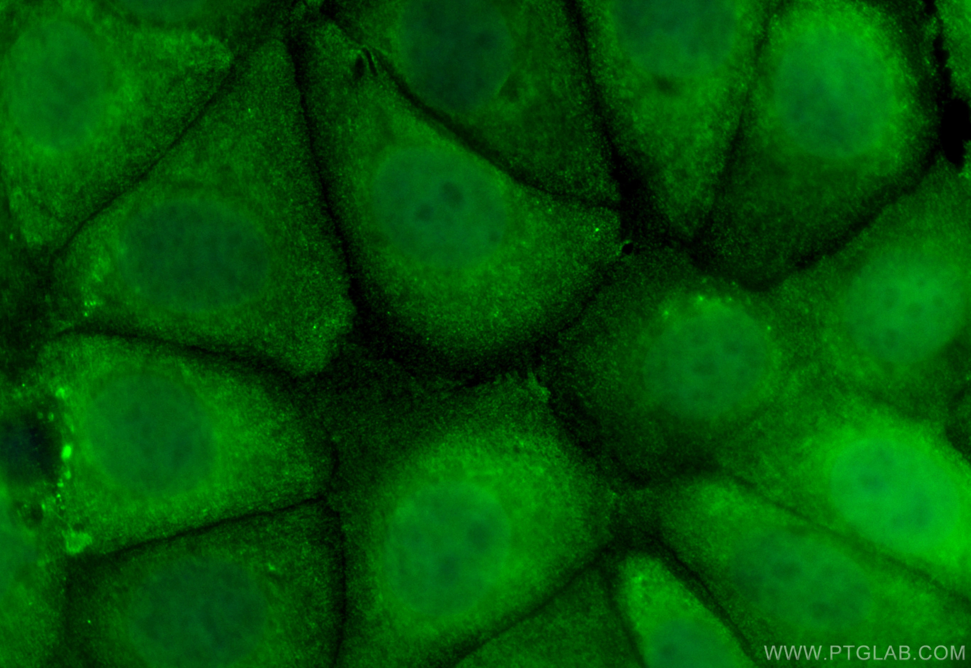 Immunofluorescence (IF) / fluorescent staining of MCF-7 cells using CoraLite® Plus 488-conjugated AIM2 Monoclonal anti (CL488-66902)