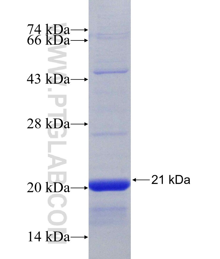 AIM2 fusion protein Ag30628 SDS-PAGE