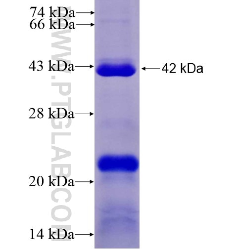 AIM2 fusion protein Ag14607 SDS-PAGE