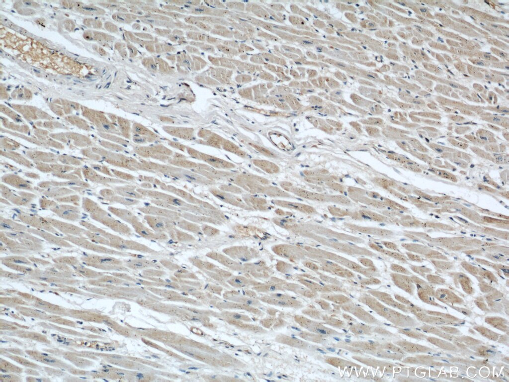 Immunohistochemistry (IHC) staining of human heart tissue using AIP/ARA9 Polyclonal antibody (18176-1-AP)