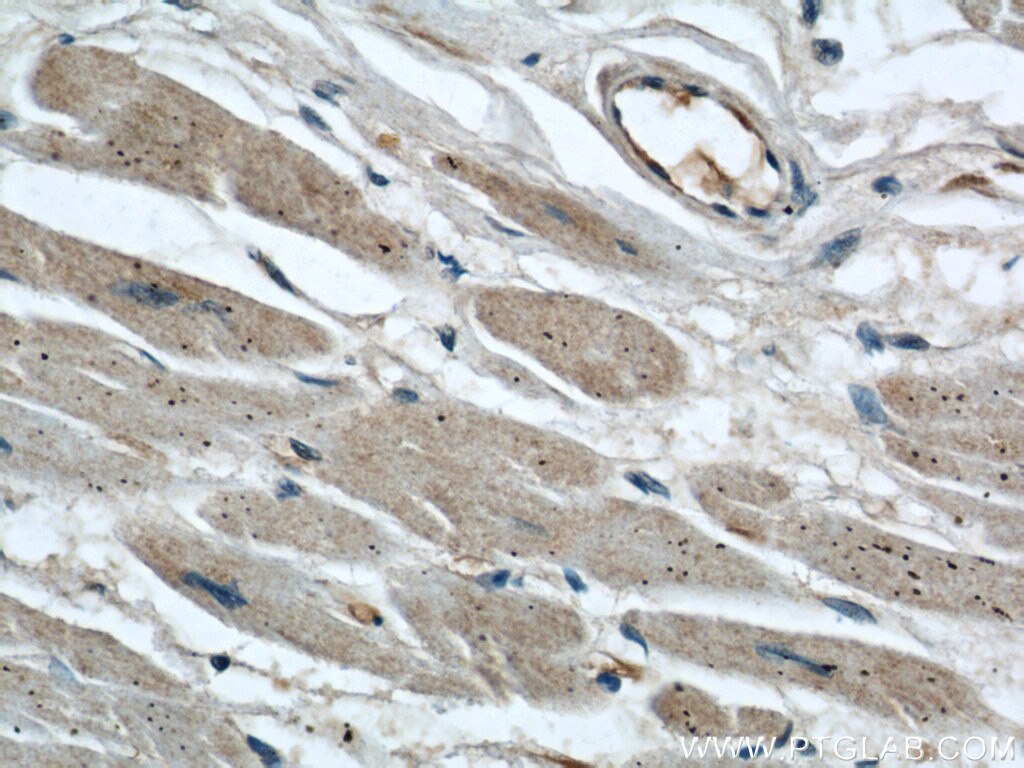 Immunohistochemistry (IHC) staining of human heart tissue using AIP/ARA9 Polyclonal antibody (18176-1-AP)