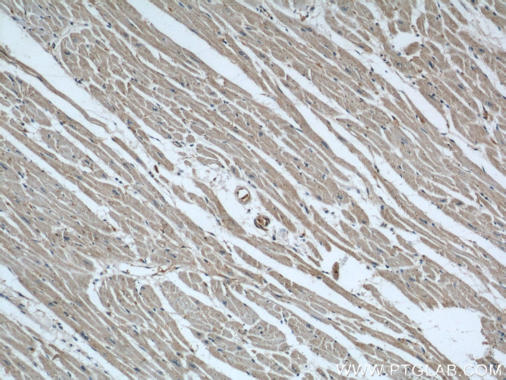 IHC staining of human heart using 18176-1-AP