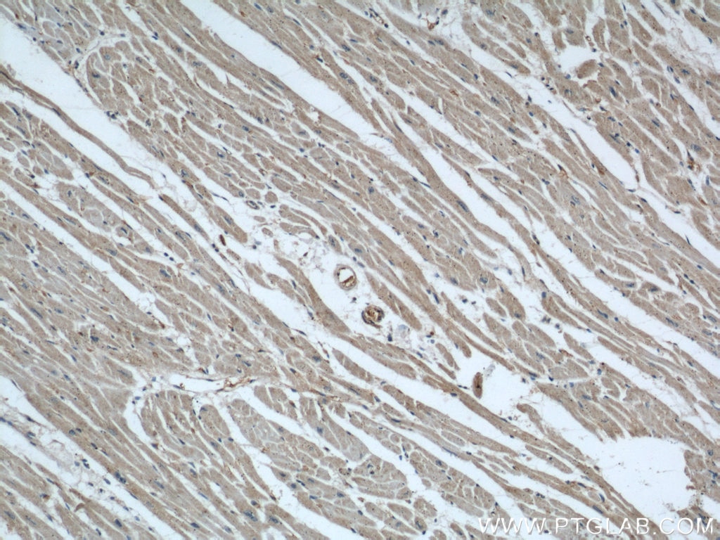 Immunohistochemistry (IHC) staining of human heart tissue using AIP/ARA9 Polyclonal antibody (18176-1-AP)