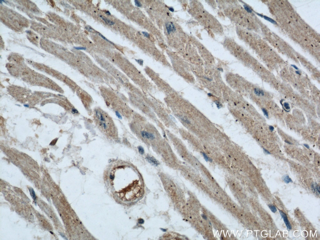 Immunohistochemistry (IHC) staining of human heart tissue using AIP/ARA9 Polyclonal antibody (18176-1-AP)