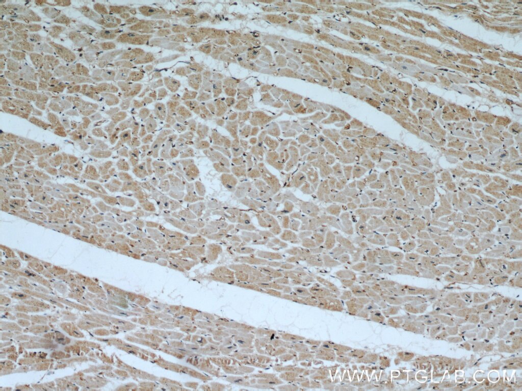 Immunohistochemistry (IHC) staining of human heart tissue using AIP/ARA9 Polyclonal antibody (18176-1-AP)