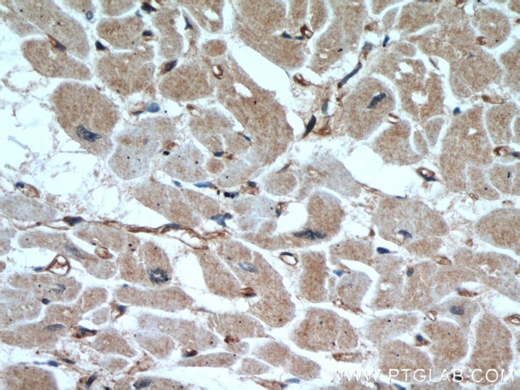 Immunohistochemistry (IHC) staining of human heart tissue using AIP/ARA9 Polyclonal antibody (18176-1-AP)