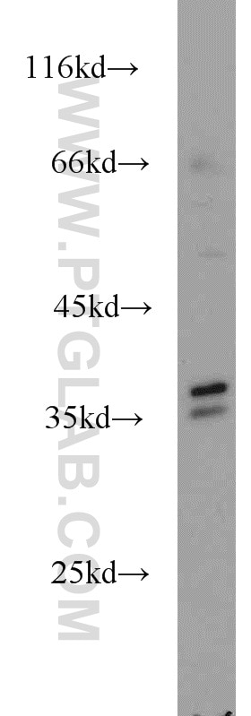 Western Blot (WB) analysis of HeLa cells using AIP/ARA9 Polyclonal antibody (18176-1-AP)