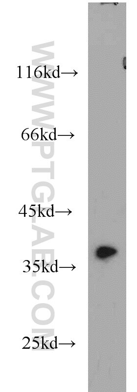 Western Blot (WB) analysis of HepG2 cells using AIP/ARA9 Polyclonal antibody (18176-1-AP)