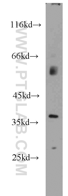 Western Blot (WB) analysis of NIH/3T3 cells using AIP/ARA9 Polyclonal antibody (18176-1-AP)