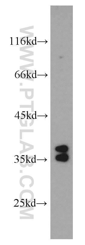 Western Blot (WB) analysis of HeLa cells using AIP/ARA9 Polyclonal antibody (18176-1-AP)