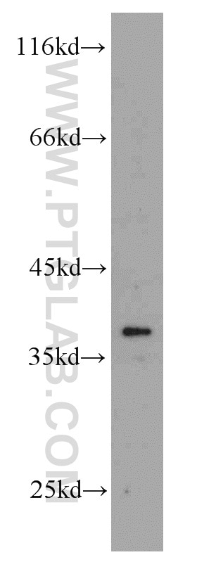 Western Blot (WB) analysis of HepG2 cells using AIP/ARA9 Polyclonal antibody (18176-1-AP)