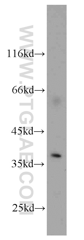 Western Blot (WB) analysis of NIH/3T3 cells using AIP/ARA9 Polyclonal antibody (18176-1-AP)