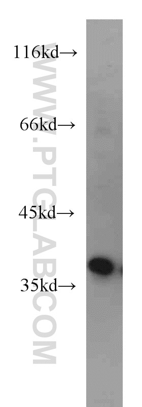 Western Blot (WB) analysis of HepG2 cells using AIP/ARA9 Polyclonal antibody (18176-1-AP)