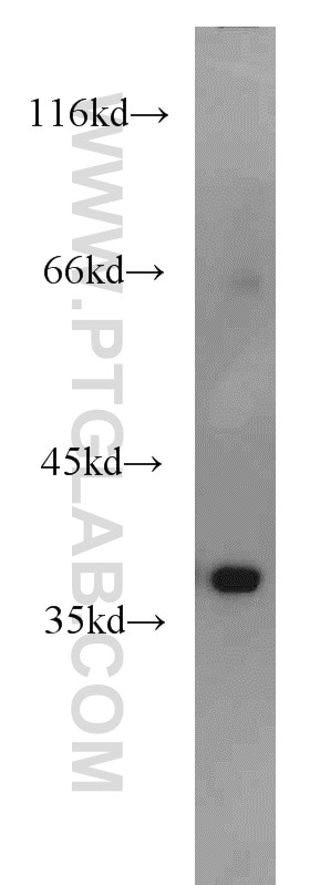 WB analysis of HepG2 using 18176-1-AP