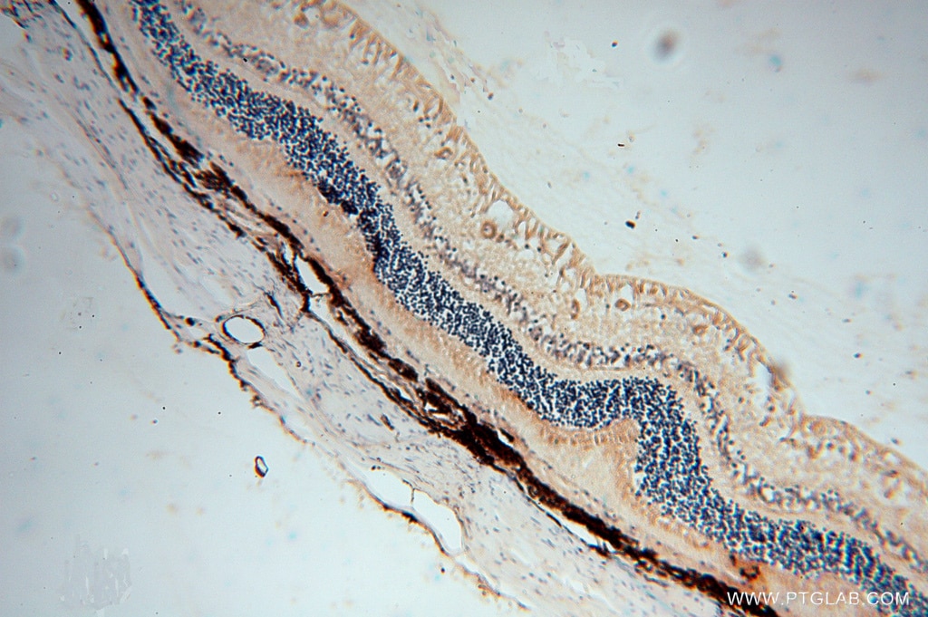 Immunohistochemistry (IHC) staining of human eye tissue using AIPL1 Polyclonal antibody (15108-1-AP)