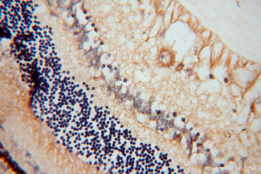 Immunohistochemistry (IHC) staining of human eye tissue using AIPL1 Polyclonal antibody (15108-1-AP)