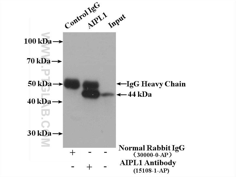 Immunoprecipitation (IP) experiment of Y79 cells using AIPL1 Polyclonal antibody (15108-1-AP)