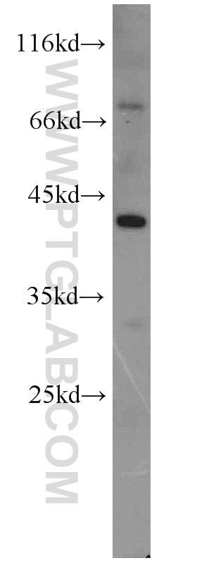 Western Blot (WB) analysis of SH-SY5Y cells using AIPL1 Polyclonal antibody (15108-1-AP)