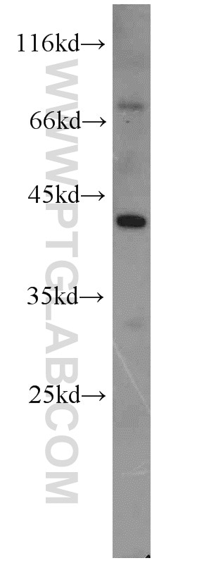 Western Blot (WB) analysis of SH-SY5Y cells using AIPL1 Polyclonal antibody (15108-1-AP)