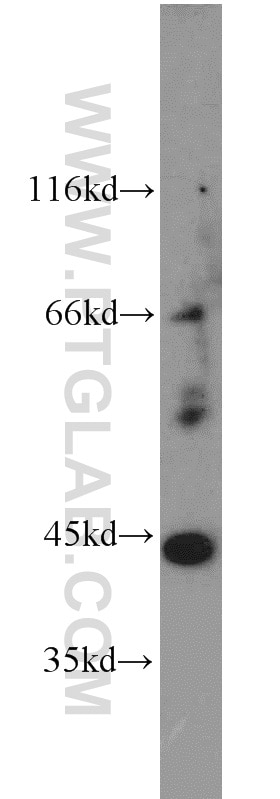 Western Blot (WB) analysis of mouse brain tissue using AIPL1 Polyclonal antibody (15108-1-AP)