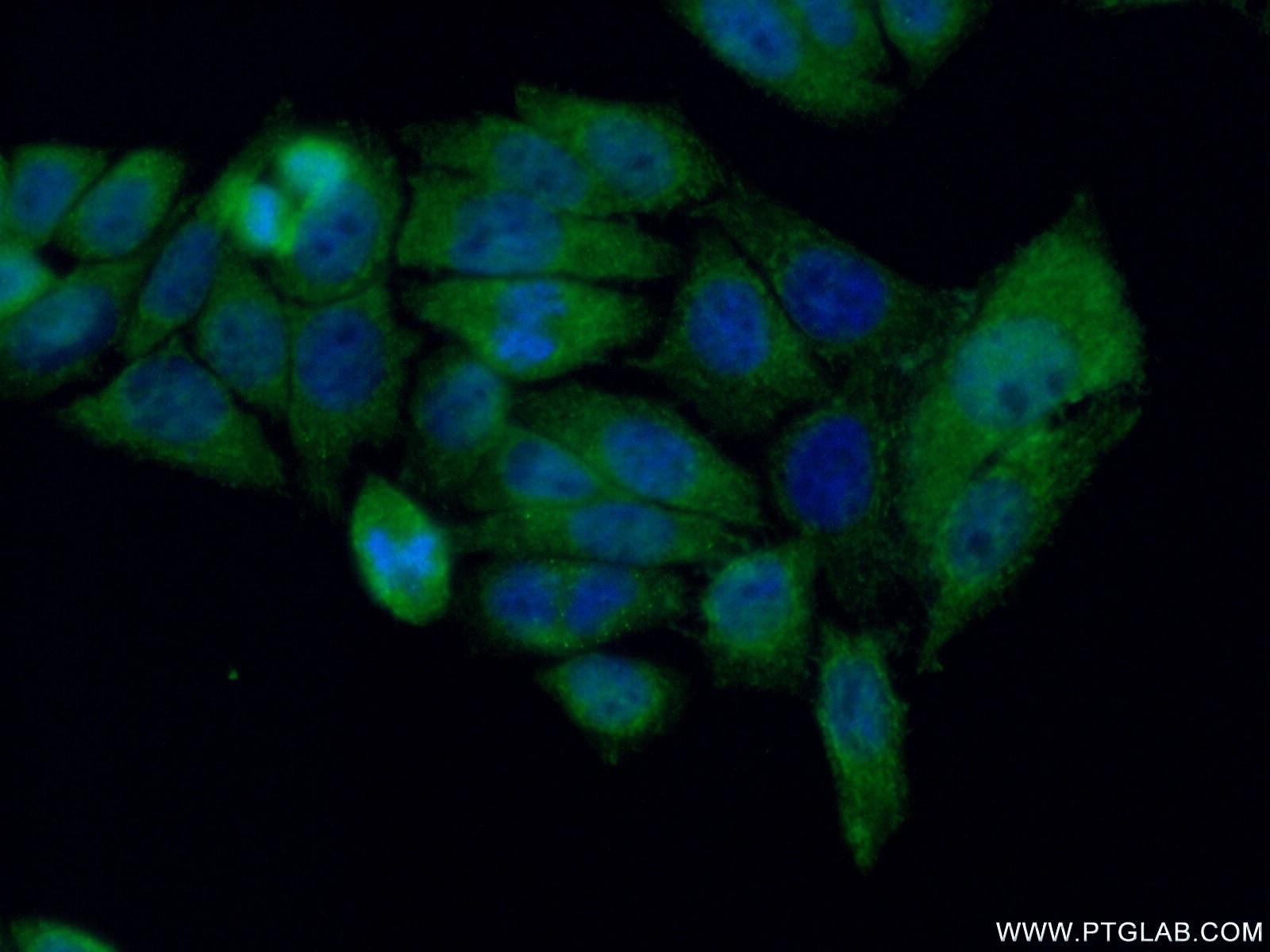 Immunofluorescence (IF) / fluorescent staining of HeLa cells using AIRE Polyclonal antibody (22517-1-AP)