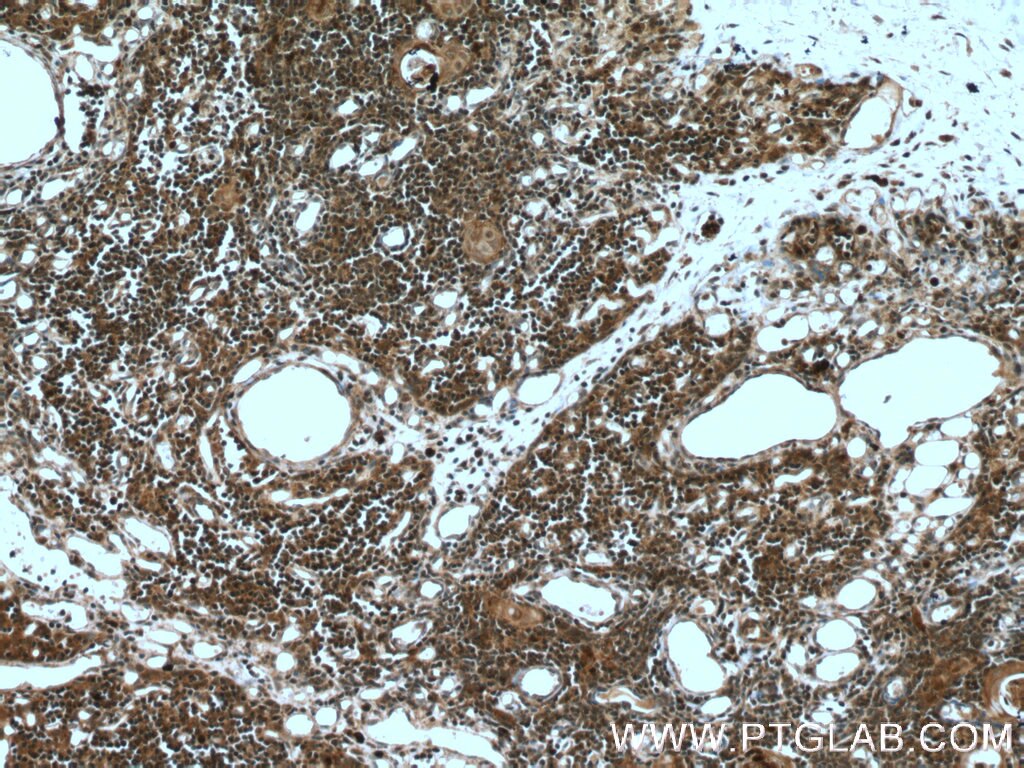 IHC staining of human thymus using 22517-1-AP