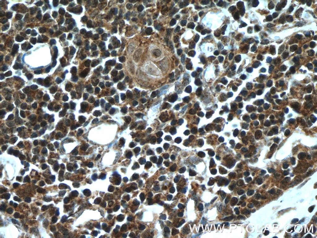 Immunohistochemistry (IHC) staining of human thymus tissue using AIRE Polyclonal antibody (22517-1-AP)