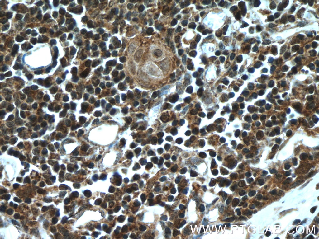 IHC staining of human thymus using 22517-1-AP