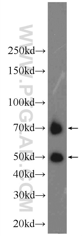 WB analysis of human spleen using 22517-1-AP