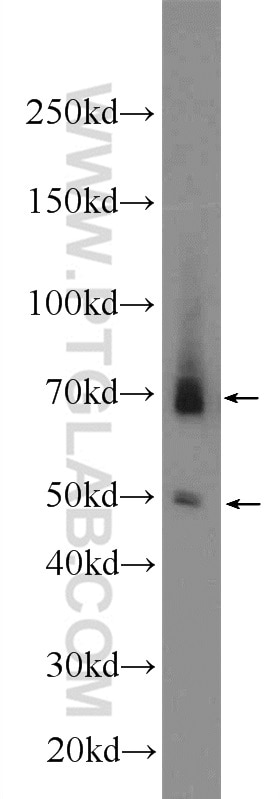 Western Blot (WB) analysis of mouse thymus tissue using AIRE Polyclonal antibody (22517-1-AP)
