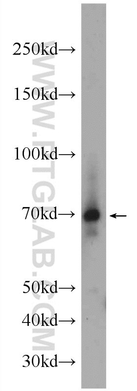 Western Blot (WB) analysis of human plasma using AIRE Polyclonal antibody (22517-1-AP)