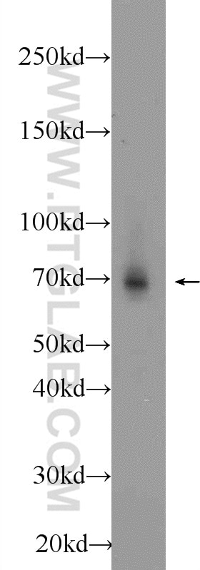 Western Blot (WB) analysis of U-937 cells using AIRE Polyclonal antibody (22517-1-AP)