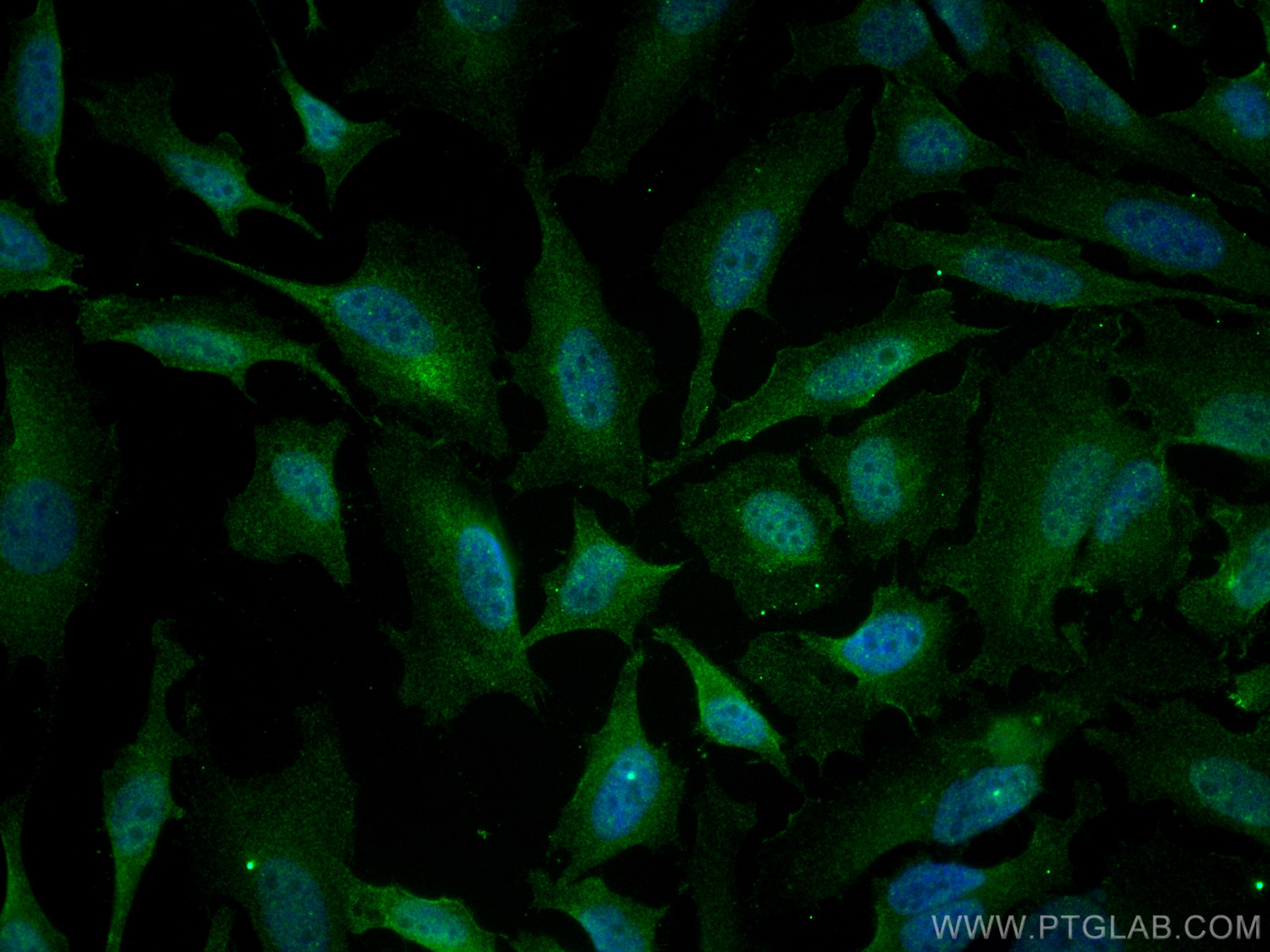Immunofluorescence (IF) / fluorescent staining of HeLa cells using AIRE Monoclonal antibody (66262-1-Ig)