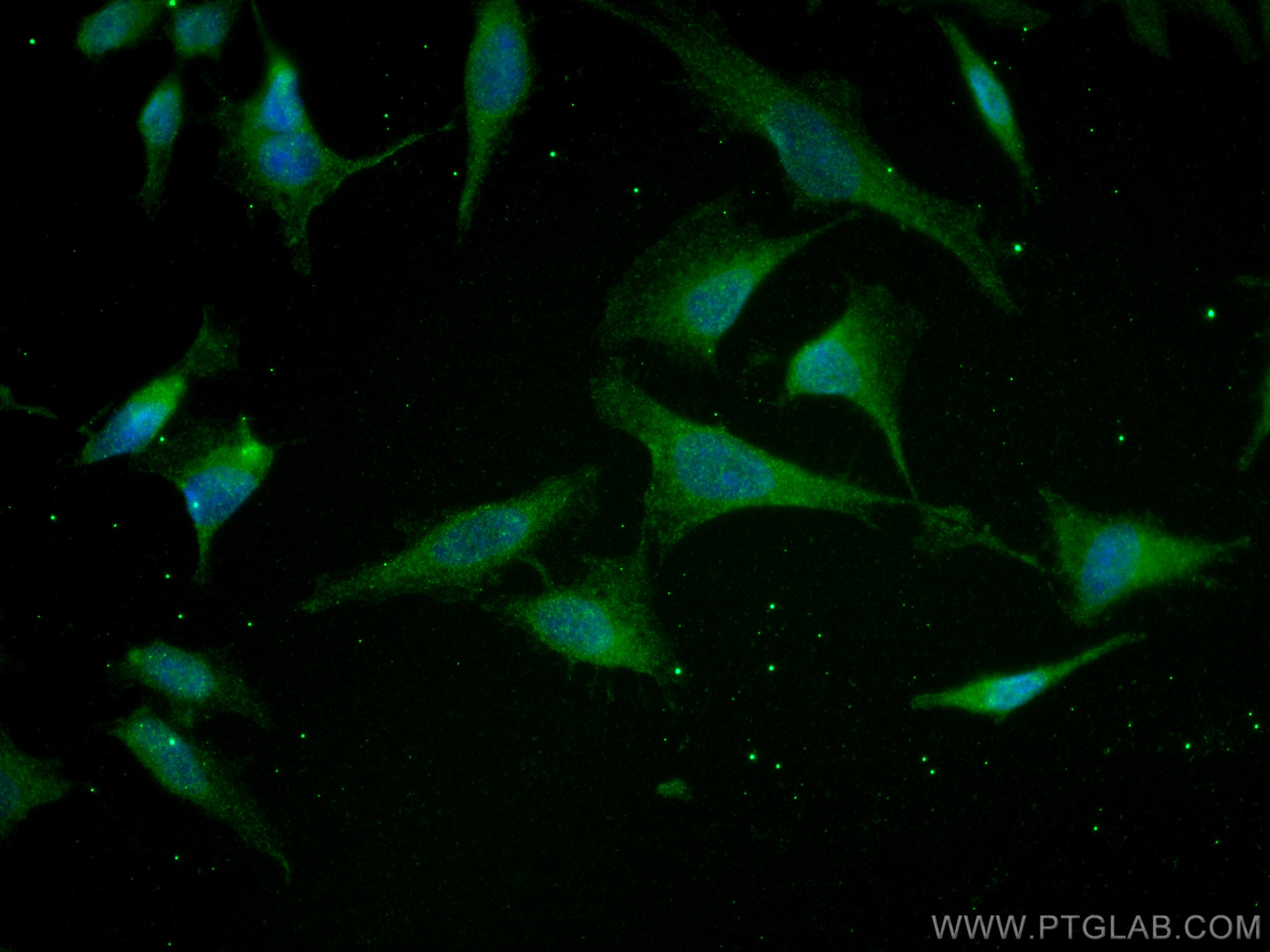 Immunofluorescence (IF) / fluorescent staining of HeLa cells using AIRE Monoclonal antibody (66262-1-Ig)