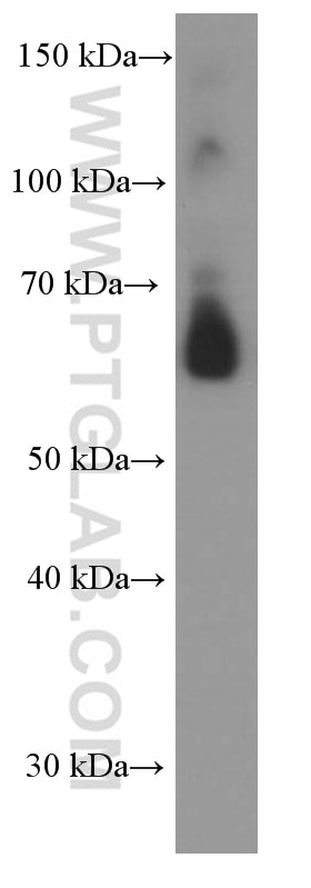 Western Blot (WB) analysis of human spleen tissue using AIRE Monoclonal antibody (66262-1-Ig)