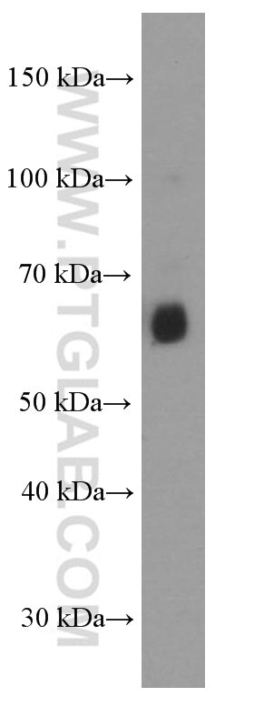 Western Blot (WB) analysis of human spleen tissue using AIRE Monoclonal antibody (66262-1-Ig)