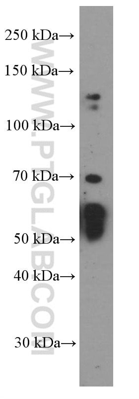 Western Blot (WB) analysis of pig spleen tissue using AIRE Monoclonal antibody (66262-1-Ig)