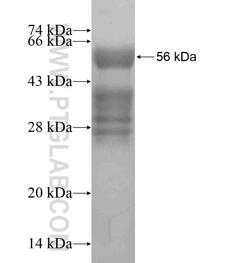 AIRE fusion protein Ag18249 SDS-PAGE