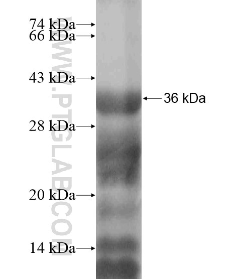 AIRE fusion protein Ag19103 SDS-PAGE