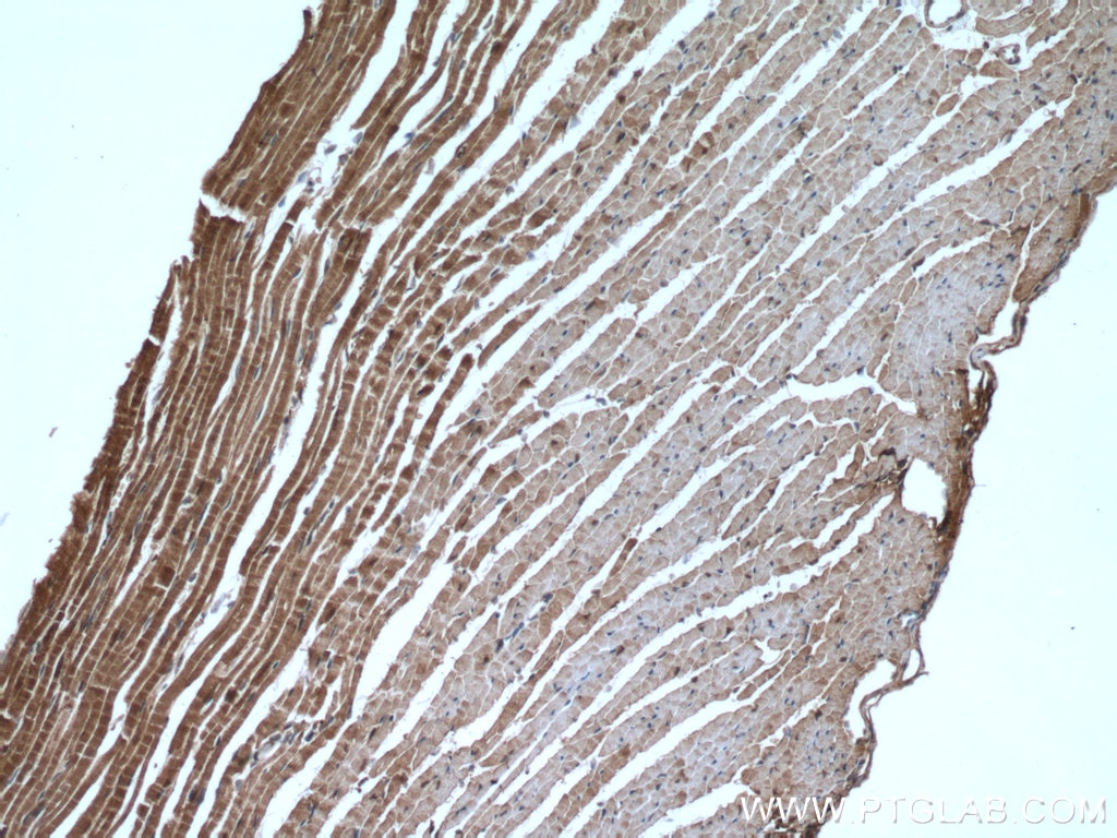 Immunohistochemistry (IHC) staining of mouse heart tissue using AK1 Polyclonal antibody (14978-1-AP)